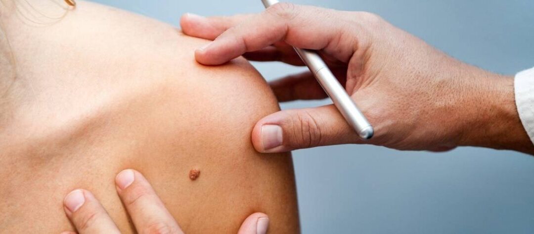 Dermatology